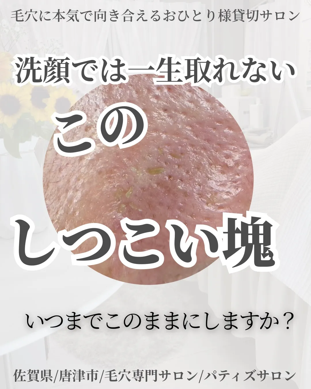 暑い日や湿気でジメジメな日も増え毛穴トラブルが多くなる季節に...