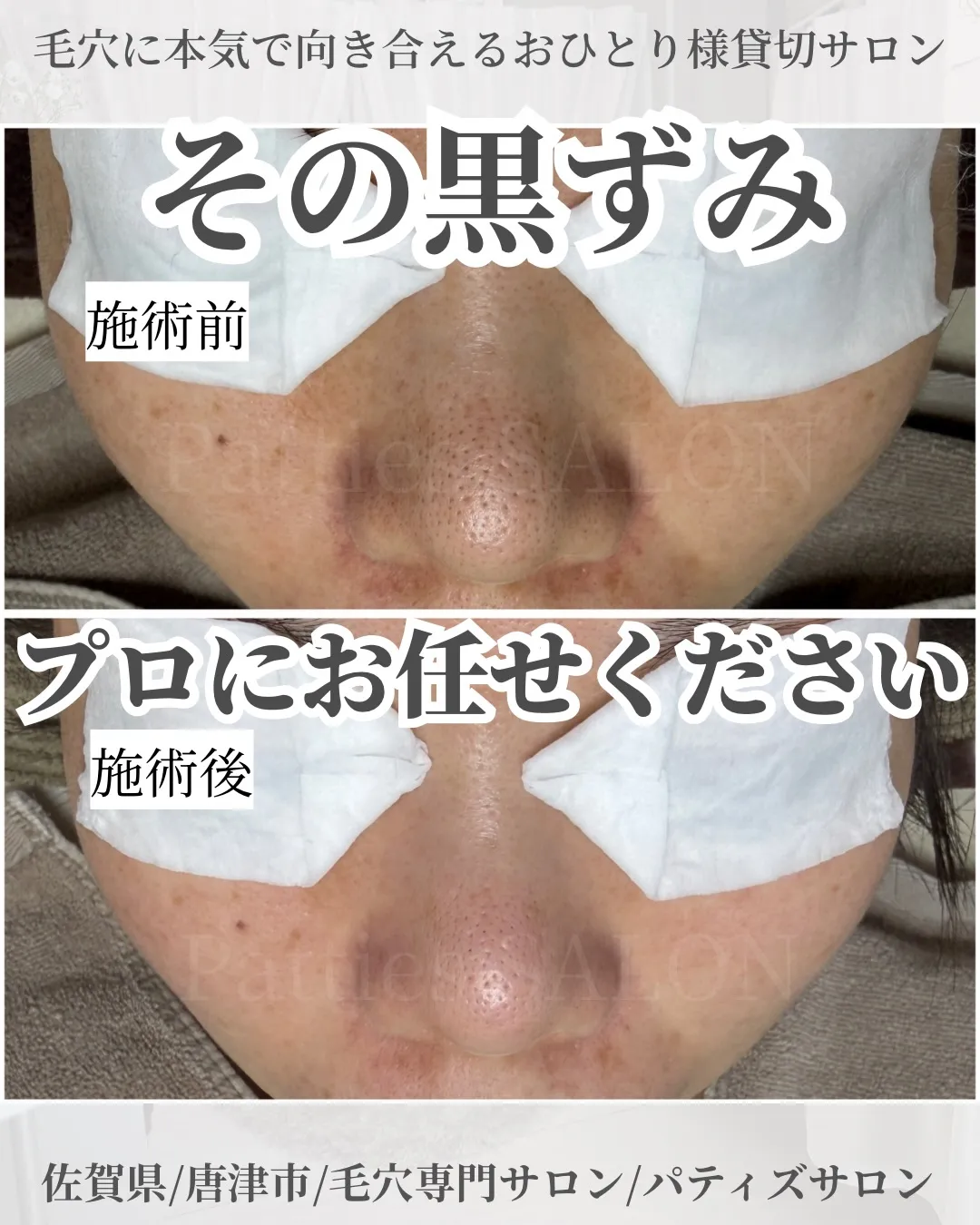 暑い日や湿気でジメジメな日も増え毛穴トラブルが多くなる季節に...